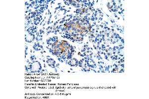 Immunohistochemistry (IHC) image for anti-Purinergic Receptor P2X, Ligand Gated Ion Channel 1 (P2RX1) (Middle Region) antibody (ABIN2776150)