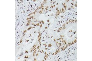 Immunohistochemistry (IHC) image for anti-GATA Binding Protein 4 (GATA4) (AA 50-150) antibody (ABIN6140975)
