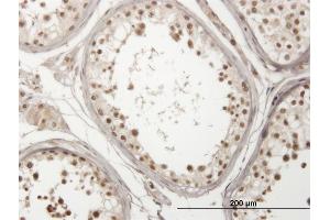 Immunoperoxidase of monoclonal antibody to USP29 on formalin-fixed paraffin-embedded human testis. (USP29 antibody  (AA 131-240))