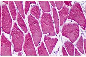 Anti-CAMK1D antibody IHC staining of human skeletal muscle. (CAMK1D antibody  (AA 1-96))