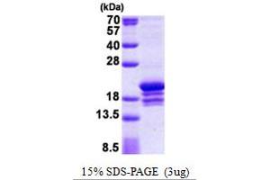 SDS-PAGE (SDS) image for Polymerase (DNA Directed), epsilon 3 (p17 Subunit) (POLE3) (AA 1-147) protein (His tag) (ABIN5853016)