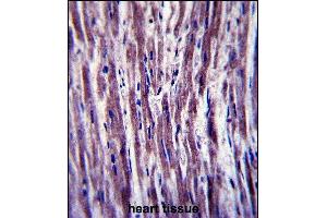 PTPLA Antibody (N-term) (ABIN657409 and ABIN2846449) immunohistochemistry analysis in formalin fixed and paraffin embedded human heart tissue followed by peroxidase conjugation of the secondary antibody and DAB staining. (PTPLA antibody  (N-Term))