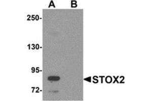 Western blot analysis of STOX2 in human kidney tissue lysate with STOX2 antibody at 1 μg/ml in (A) the absence and (B) the presence of blocking peptide. (STOX2 antibody  (C-Term))