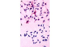 Immunocytochemical staining of HEK293 human embryonic kidney cells transfected (A) and untranfected (B) with C5AR1. (C5AR1 antibody  (N-Term))