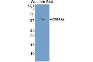 Western blot analysis of the recombinant protein. (SFRP4 antibody  (AA 22-346))