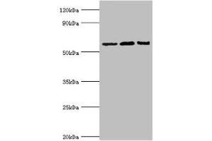 Western blot All lanes: Interleukin-10 receptor subunit alpha antibody at 8 μg/mL Lane 1: Mouse heart tissue Lane 2: Hela whole cell lysate Lane 3: Mouse liver tissue Secondary Goat polyclonal to rabbit IgG at 1/10000 dilution Predicted band size: 63 kDa Observed band size: 63 kDa (IL1RN antibody  (AA 22-230))