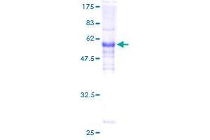 LIM Domain Binding 3 Protein Protein (AA 1-283) (GST tag)