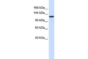 WB Suggested Anti-IGSF1 Antibody Titration:  0. (IGSF1 antibody  (N-Term))
