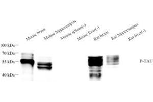 Western blot analysis of phospho-TAU (S202/T205) (ABIN7075838) at dilution of 1: 1000 (tau antibody  (pSer202, pThr205))