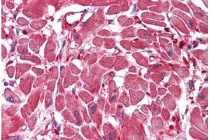 Human Heart: Formalin-Fixed, Paraffin-Embedded (FFPE) (ACOT9 antibody  (AA 1-213))