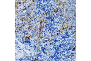 Immunohistochemistry (IHC) image for anti-Tumor Necrosis Factor Receptor Superfamily, Member 1A (TNFRSF1A) (AA 22-211) antibody (ABIN1513619)