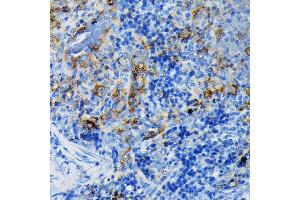 Immunohistochemistry of paraffin-embedded mouse spleen using TNFR1/TNFRSF1A Rabbit pAb (ABIN3022103, ABIN3022104, ABIN1513619 and ABIN6218606) at dilution of 1:100 (40x lens). (TNFRSF1A antibody  (AA 22-211))