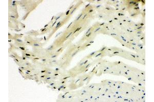 Anti- SLUG Picoband antibody,IHC(P) IHC(P): Mouse Cardiac Muscle Tissue (SLUG antibody  (Middle Region))