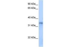 Western Blotting (WB) image for anti-Four and A Half LIM Domains 5 (FHL5) antibody (ABIN2463444)