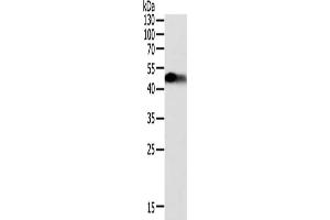 Gel: 12 % SDS-PAGE, Lysate: 40 μg, Lane: Human fetal kidney tissue, Primary antibody: ABIN7131078(SLC12A1 Antibody) at dilution 1/200, Secondary antibody: Goat anti rabbit IgG at 1/8000 dilution, Exposure time: 1 minute (SLC12A1 antibody)