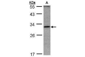 WB Image Sample(30 ug whole cell lysate) A:Hep G2 , 12% SDS PAGE antibody diluted at 1:1000 (ANKRD45 antibody)