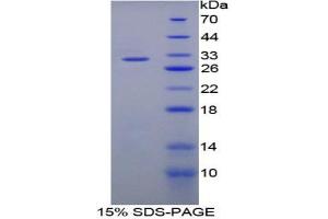 SDS-PAGE analysis of Rat Matrix Metalloproteinase 8 (MMP8) Protein. (MMP8 Protein)