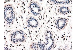 Immunohistochemical staining of paraffin-embedded breast tissue using anti-NRBP1 mouse monoclonal antibody. (NRBP1 antibody)