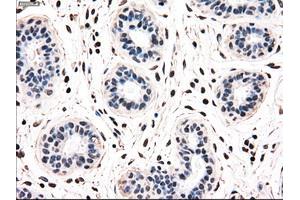 Immunohistochemical staining of paraffin-embedded breast tissue using anti-NRBP1 mouse monoclonal antibody. (NRBP1 antibody)