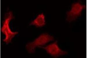 ABIN6275017 staining RAW264. (Claudin 6 antibody  (Internal Region))