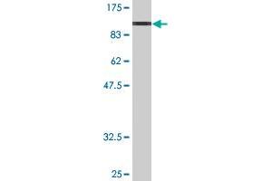 Western Blot detection against Immunogen (97. (FUBP1 antibody  (AA 1-653))