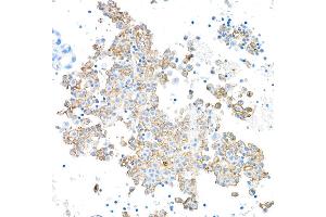 Immunohistochemistry (IHC) image for anti-Fc Fragment of IgG, Low Affinity IIIa, Receptor (CD16a) (FCGR3A) (AA 204-254) antibody (ABIN7449424)