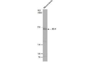 WB Image Mouse tissue extract (50 μg) was separated by 5% SDS-PAGE, and the membrane was blotted with ZO-1 antibody [N1N2], N-term , diluted at 1:500. (TJP1 antibody  (N-Term))