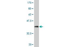 Western Blot detection against Immunogen (42. (NPC2 antibody  (AA 1-151))