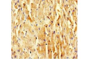 Immunohistochemistry of paraffin-embedded human heart tissue using ABIN7169521 at dilution of 1:100