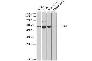 Western blot analysis of extracts of various cell lines using EPHX1 Polyclonal Antibody at dilution of 1:1000.