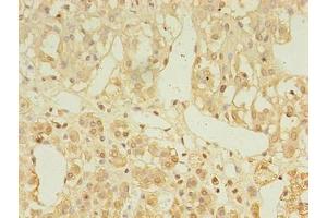Immunohistochemistry of paraffin-embedded human adrenal gland tissue using ABIN7158414 at dilution of 1:100 (LDAH/C2orf43 antibody  (AA 1-325))