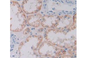 #VALUE! (XYLT2 antibody  (AA 596-865))