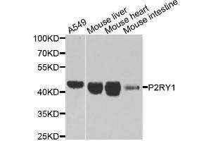 Western blot analysis of extracts of various cell lines, using P2RY1 antibody (ABIN5975167) at 1/1000 dilution. (P2RY1 antibody)