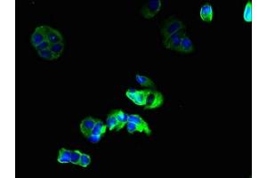Immunofluorescent analysis of MCF-7 cells using ABIN7153625 at dilution of 1:100 and Alexa Fluor 488-congugated AffiniPure Goat Anti-Rabbit IgG(H+L) (GJB6 antibody  (AA 216-261))