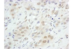 Immunohistochemistry (IHC) image for anti-Jun B Proto-Oncogene (JUNB) (AA 40-80) antibody (ABIN7453504)