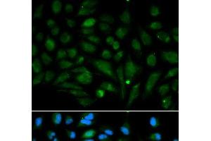 Immunofluorescence analysis of MCF-7 cells using Decorin Polyclonal Antibody (Decorin antibody)