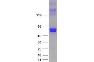 Western Blotting (WB) image for Doublecortin-Like Kinase 1 (DCLK1) (Transcript Variant 3) protein (Myc-DYKDDDDK Tag) (ABIN2719685)