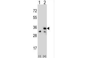 Western blot analysis of VDAC1 (arrow) using rabbit polyclonal VDAC1 Antibody (Center) (ABIN390564 and ABIN2840894).