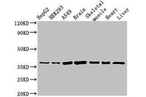 Western Blot Positive WB detected in: HepG2 whole cell lysate, HEK293 whole cell lysate, A549 whole cell lysate, Mouse brain tissue, Mouse skeletal muscle tissue, Rat heart tissue, Rat liver tissue All lanes: MYF6 antibody at 3 μg/mL Secondary Goat polyclonal to rabbit IgG at 1/50000 dilution Predicted band size: 27 kDa Observed band size: 37 kDa (MYF6 antibody  (AA 26-232))