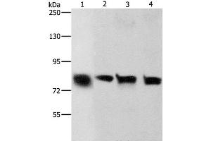 Western Blot analysis of Hela and A549 cell, Human liver cancer tissue and HT-29 cell using K-Cadherin Polyclonal Antibody at dilution of 1:500 (CDH6 antibody)