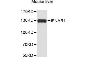 Western blot analysis of extracts of mouse liver, using IFNAR1 antibody (ABIN5970858) at 1/1000 dilution. (IFNAR1 antibody)
