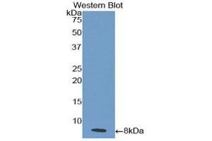 Western Blotting (WB) image for anti-Interleukin 18 Receptor 1 (IL18R1) (AA 375-428) antibody (ABIN1859374) (IL18R1 antibody  (AA 375-428))