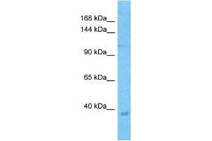 Western Blotting (WB) image for anti-Zinc Finger Protein GLI1 (GLI1) (C-Term) antibody (ABIN2779593)