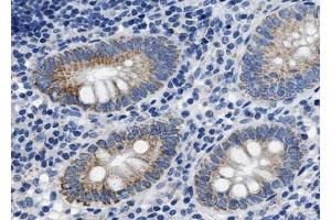 ABIN6267651 at 1/100 staining human Appendix tissue sections by IHC-P. (Caspase 8 antibody  (pSer347))