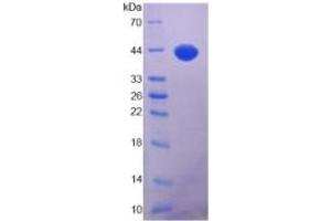 SDS-PAGE of Protein Standard from the Kit  (Highly purified E. (IGF1 ELISA Kit)