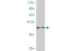 Western Blot detection against Immunogen (37. (NCOR1 antibody  (AA 2341-2440))