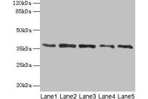 Western blot All lanes: PLAUR antibody at 4 μg/mL Lane 1: Mouse brain tissue Lane 2: A2780 whole cell lysate Lane 3: MCF-7 whole cell lysate Lane 4: Hela whole cell lysate Lane 5: Colo320 whole cell lysate Secondary Goat polyclonal to rabbit IgG at 1/10000 dilution Predicted band size: 37, 32, 33 kDa Observed band size: 37 kDa (PLAUR antibody  (AA 23-305))