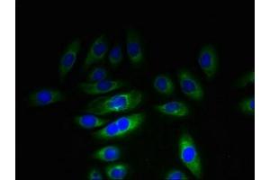 Immunofluorescent analysis of A549 cells using ABIN7157483 at dilution of 1:100 and Alexa Fluor 488-congugated AffiniPure Goat Anti-Rabbit IgG(H+L) (KHDC1 antibody  (AA 74-237))