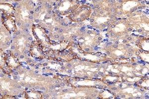 Immunohistochemistry analysis of paraffin-embedded mouse kidney using,PSMD8 (ABIN7075226) at dilution of 1: 2600