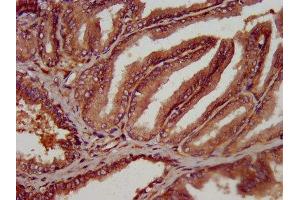 IHC image of ABIN7162139 diluted at 1:300 and staining in paraffin-embedded human prostate tissue performed on a Leica BondTM system. (Olfactomedin 4 antibody  (AA 224-334))